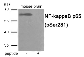 Rabbit Polyclonal Antibody to NF- kappaB p65 (Phospho-Ser281)