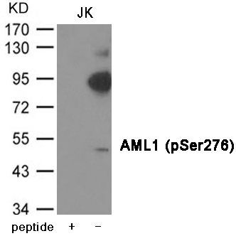Rabbit Polyclonal Antibody to AML1 (Phospho-Ser276)