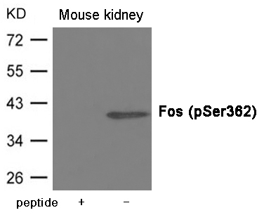 Rabbit Polyclonal Antibody to Fos (Phospho-Ser362)
