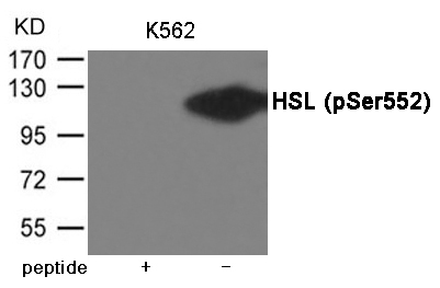 Rabbit Polyclonal Antibody to HSL (Phospho-Ser552)