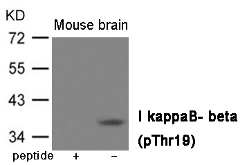 Rabbit Polyclonal Antibody to IkappaB- beta (Phospho-Thr19)