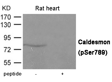 Rabbit Polyclonal Antibody to Caldesmon (Phospho-Ser789)