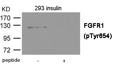 Rabbit Polyclonal Antibody to FGFR1 (Phospho-Tyr654)