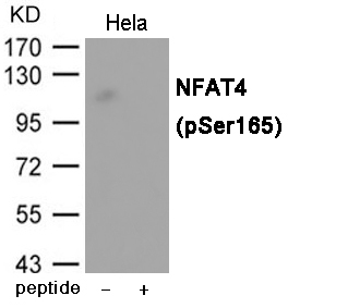 Rabbit Polyclonal Antibody to NFAT4 (Phospho-Ser165)