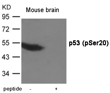 Rabbit Polyclonal Antibody to p53 (Phospho-Ser20)