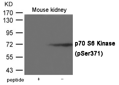 Rabbit Polyclonal Antibody to p7S6 Kinase (Phospho-Ser371)