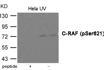 Rabbit Polyclonal Antibody to C-RAF (Phospho-Ser621)