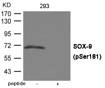 Rabbit Polyclonal Antibody to SOX-9 (Phospho-Ser181)