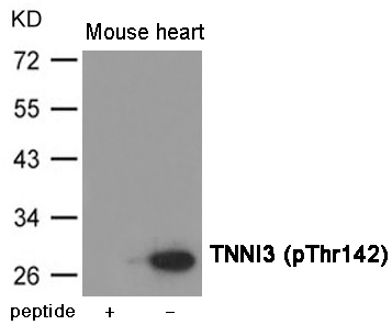 Rabbit Polyclonal Antibody to TNNI3 (Phospho-Thr142)