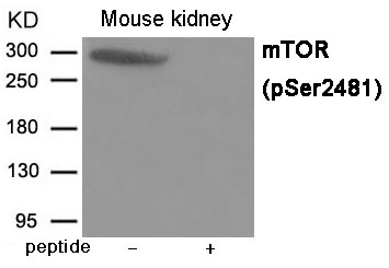 Rabbit Polyclonal Antibody to mTOR (Phospho-Ser2481)