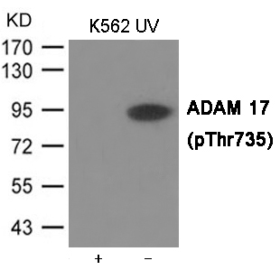 Rabbit Polyclonal Antibody to ADAM 17 (Phospho-Thr735)