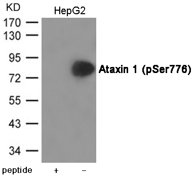 Rabbit Polyclonal Antibody to Ataxin 1 (Phospho-Ser776)