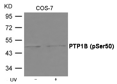 Rabbit Polyclonal Antibody to PTP1B (Phospho-Ser50)