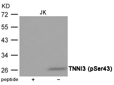 Rabbit Polyclonal Antibody to TNNI3 (Phospho-Ser43)