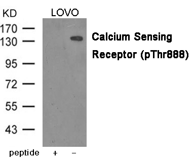 Rabbit Polyclonal Antibody to Calcium Sensing Receptor (Phospho-Thr888)