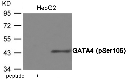 Rabbit Polyclonal Antibody to GATA4 (Phospho-Ser105)