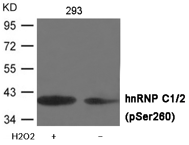 Rabbit Polyclonal Antibody to hnRNP C1/2 (Phospho-Ser260)