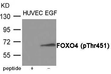 Rabbit Polyclonal Antibody to FOXO4 (Phospho-Thr451)