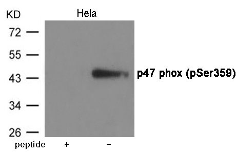 Rabbit Polyclonal Antibody to p47 phox (Phospho-Ser359)