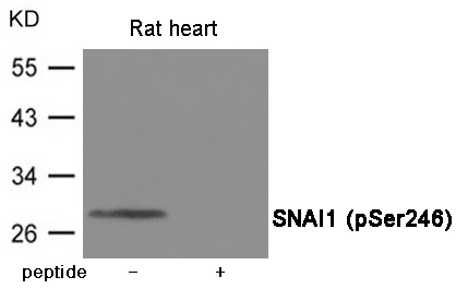 Rabbit Polyclonal Antibody to SNAI1 (Phospho-Ser246)
