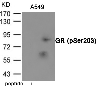 Rabbit Polyclonal Antibody to GR (Phospho-Ser203)