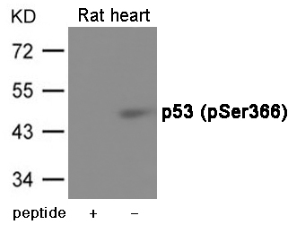 Rabbit Polyclonal Antibody to p53 (Phospho-Ser366)