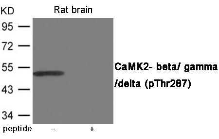 Rabbit Polyclonal Antibody to CaMK2- beta/ gamma/ delta (Phospho-Thr287)