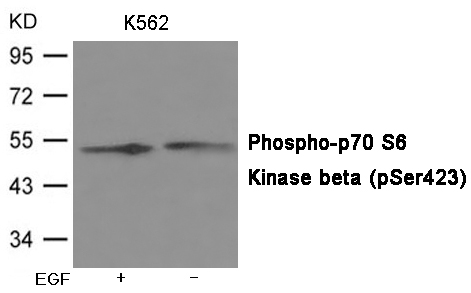 Rabbit Polyclonal Antibody to p7S6 Kinase beta (Phospho-Ser423)