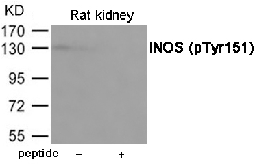 Rabbit Polyclonal Antibody to iNOS (Phospho-Tyr151)