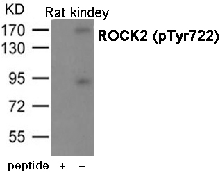 Rabbit Polyclonal Antibody to ROCK2 (Phospho-Tyr722)