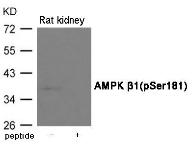 Rabbit Polyclonal Antibody to AMPK β1(Phospho-Ser181)