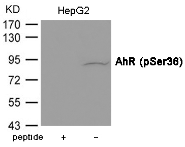 Rabbit Polyclonal Antibody to AhR (Phospho-Ser36)