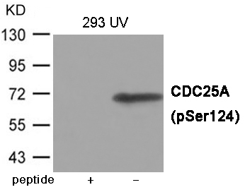 Rabbit Polyclonal Antibody to CDC25A (Phospho-Ser124)