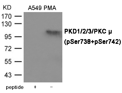 Rabbit Polyclonal Antibody to PKD1/2/3/PKC μ (Phospho-Ser738/742)