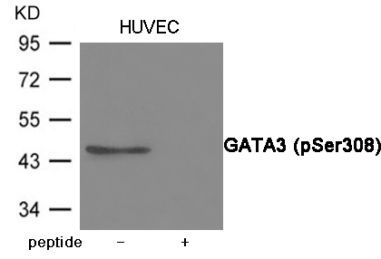Rabbit Polyclonal Antibody to GATA3 (Phospho-Ser308)