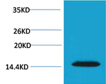 Rabbit Polyclonal Antibody to Histone H2A.X(Phospho-Thr120) Rabbit