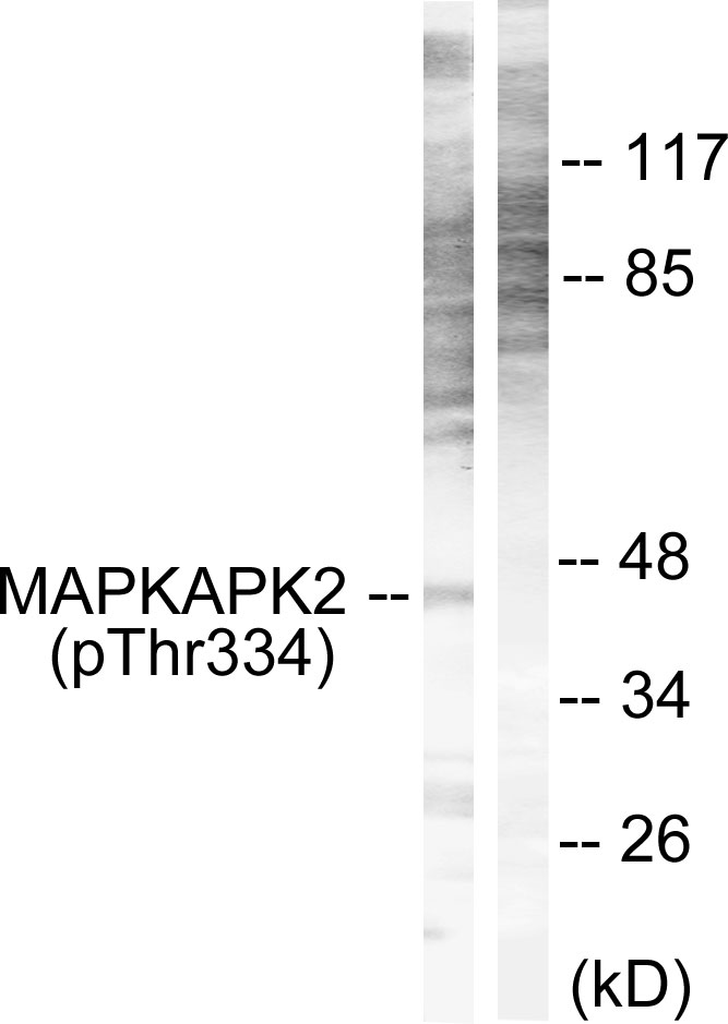 Rabbit Polyclonal Antibody to MAPKAPK2 (Phospho-Thr334)