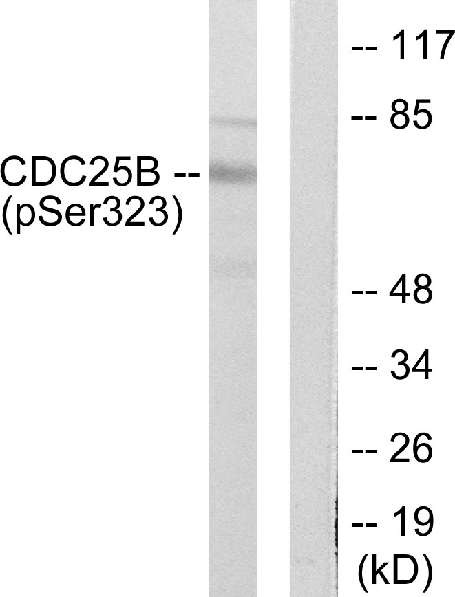 Rabbit Polyclonal Antibody to CDC25B (Phospho-Ser323)