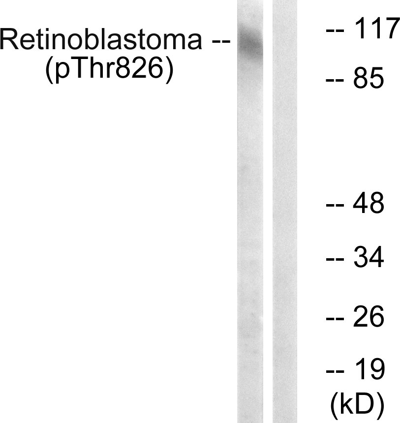 Rabbit Polyclonal Antibody to Retinoblastoma (Phospho-Thr826)