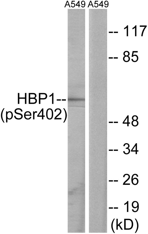 Rabbit Polyclonal Antibody to HBP1 (Phospho-Ser402)