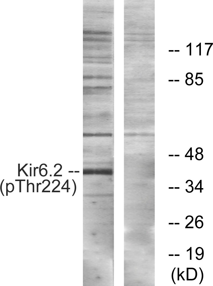 Rabbit Polyclonal Antibody to Kir6.2 (Phospho-Thr224)