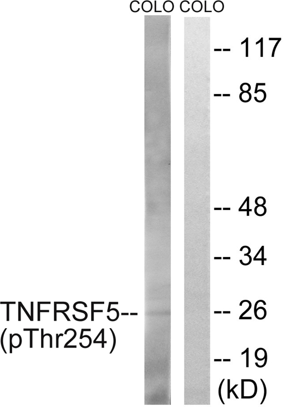 Rabbit Polyclonal Antibody to TNFRSF5 (Phospho-Thr254)