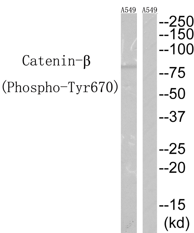 Rabbit Polyclonal Antibody to Catenin-β(Phospho-Tyr670)