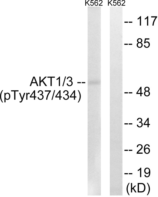 Rabbit Polyclonal Antibody to AKT1/3 (Phospho-Tyr437/434)