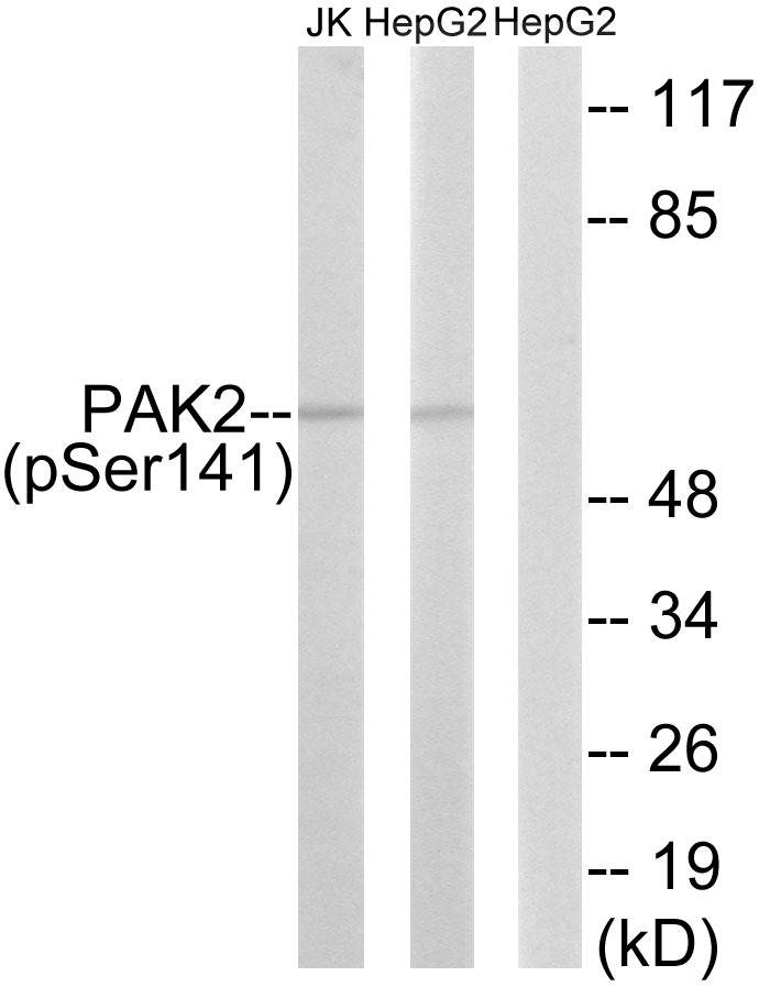 Rabbit Polyclonal Antibody to PAK2 (Phospho-Ser141)