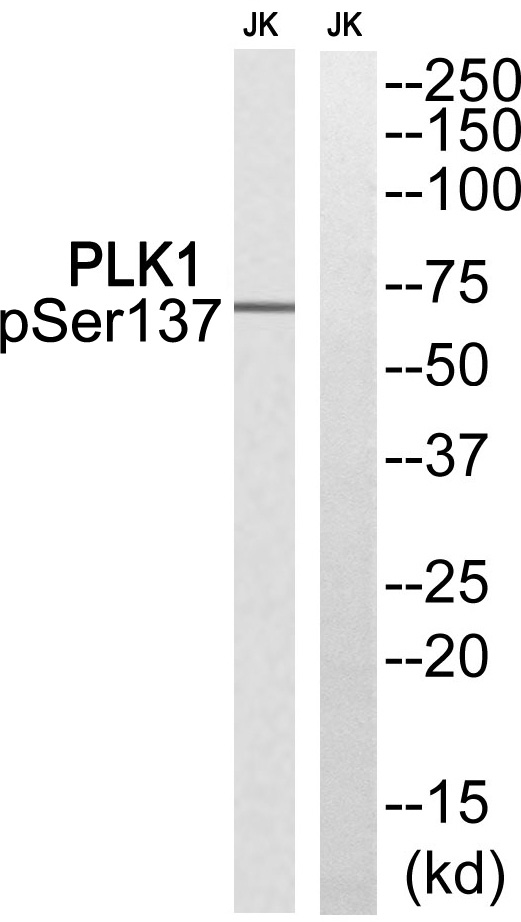 Rabbit Polyclonal Antibody to PLK1 (Phospho-Ser137)