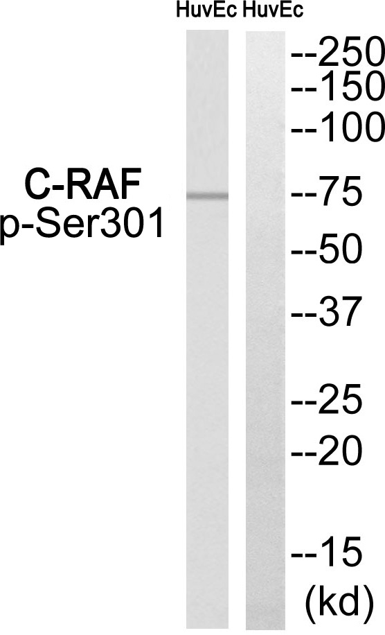 Rabbit Polyclonal Antibody to C-RAF (Phospho-Ser301)