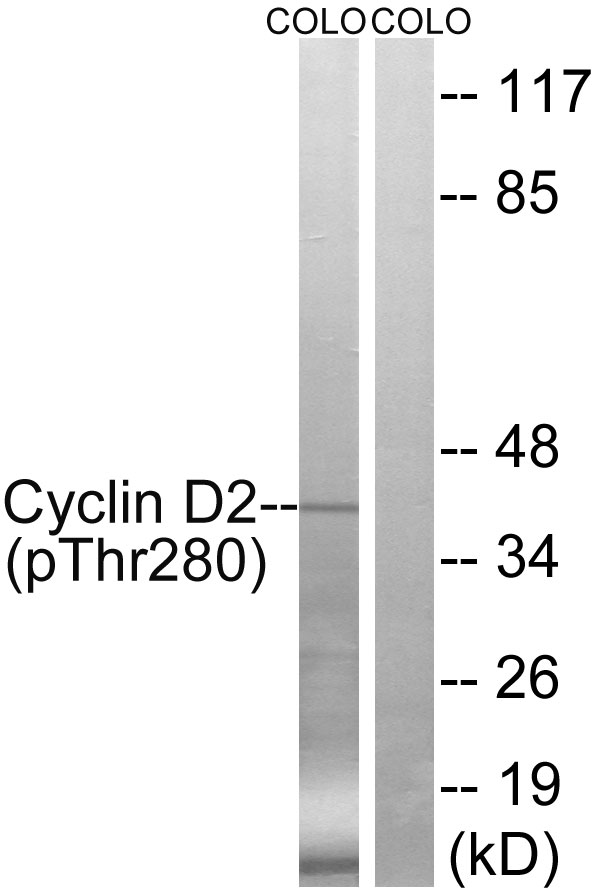 Rabbit Polyclonal Antibody to Cyclin D2 (Phospho-Thr280)
