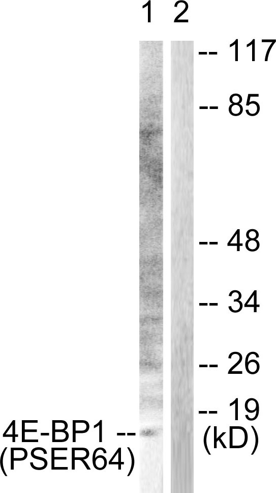 Rabbit Polyclonal Antibody to 4E-BP1 (Phospho-Ser65)