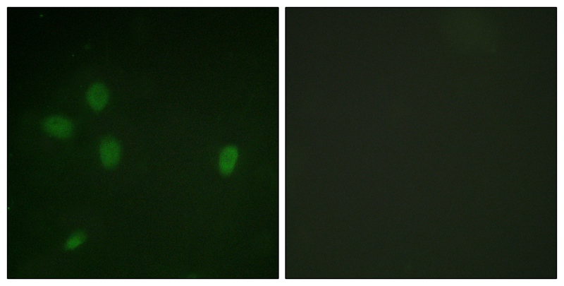 Rabbit Polyclonal Antibody to 53BP1 (Phospho-Ser25)